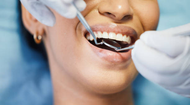 Best Mobile Emergency Dentist in Diablo Grande, CA