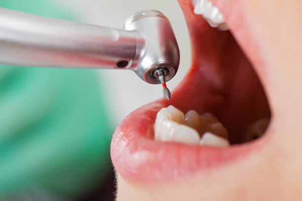 Best Orthodontic Emergency Dentist in Diablo Grande, CA